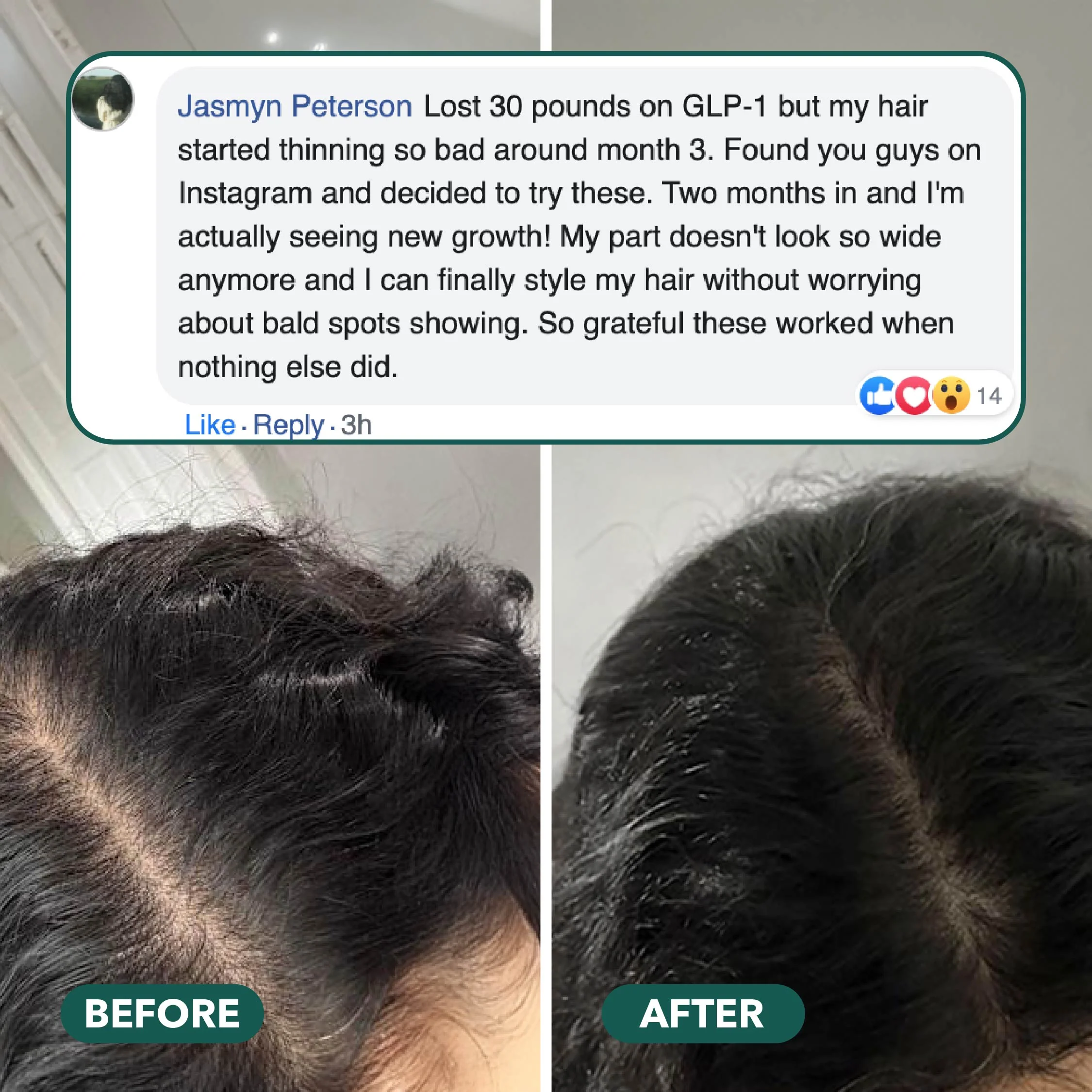 Cortisol+ Hair Recovery Bundle - Image 6