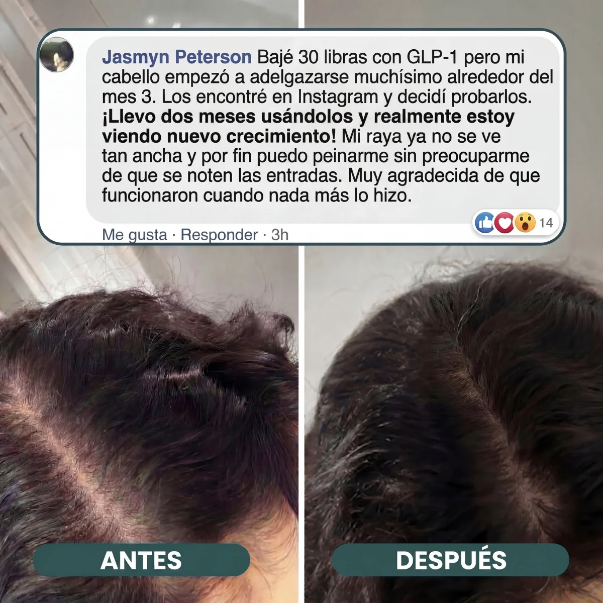 Gomitas Hair Revive - Image 5