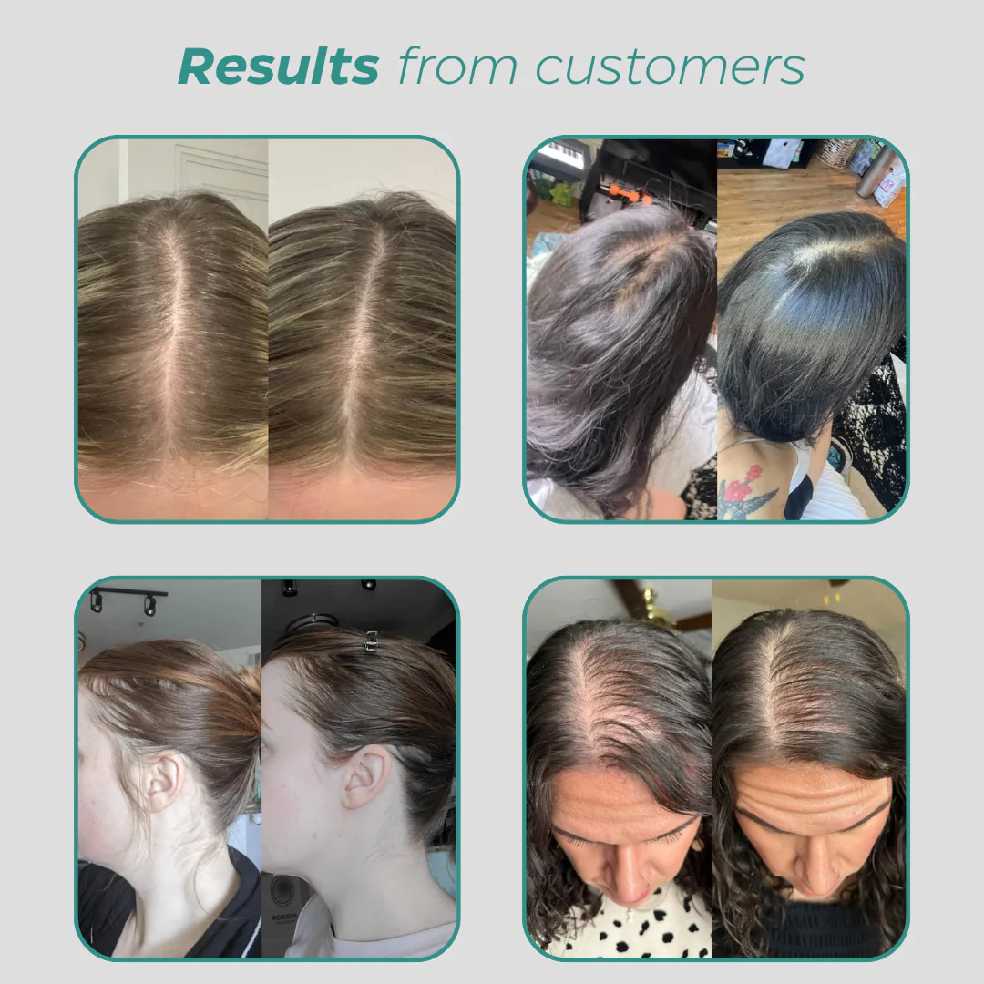 Anti-Shedding Formula - Revive Plus Mix - Image 8